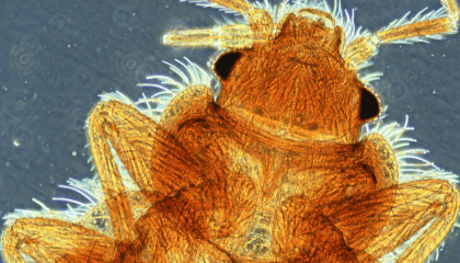 Foto microscópica de un bicho